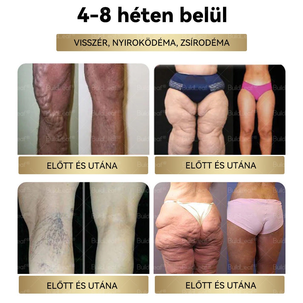 Mayo Clinic Ajánlott | Hivatalos Bolt | BuildLeaf® TIRZEPATIDE GLP-1 Gyógynövényes Orális Folyadék 👍