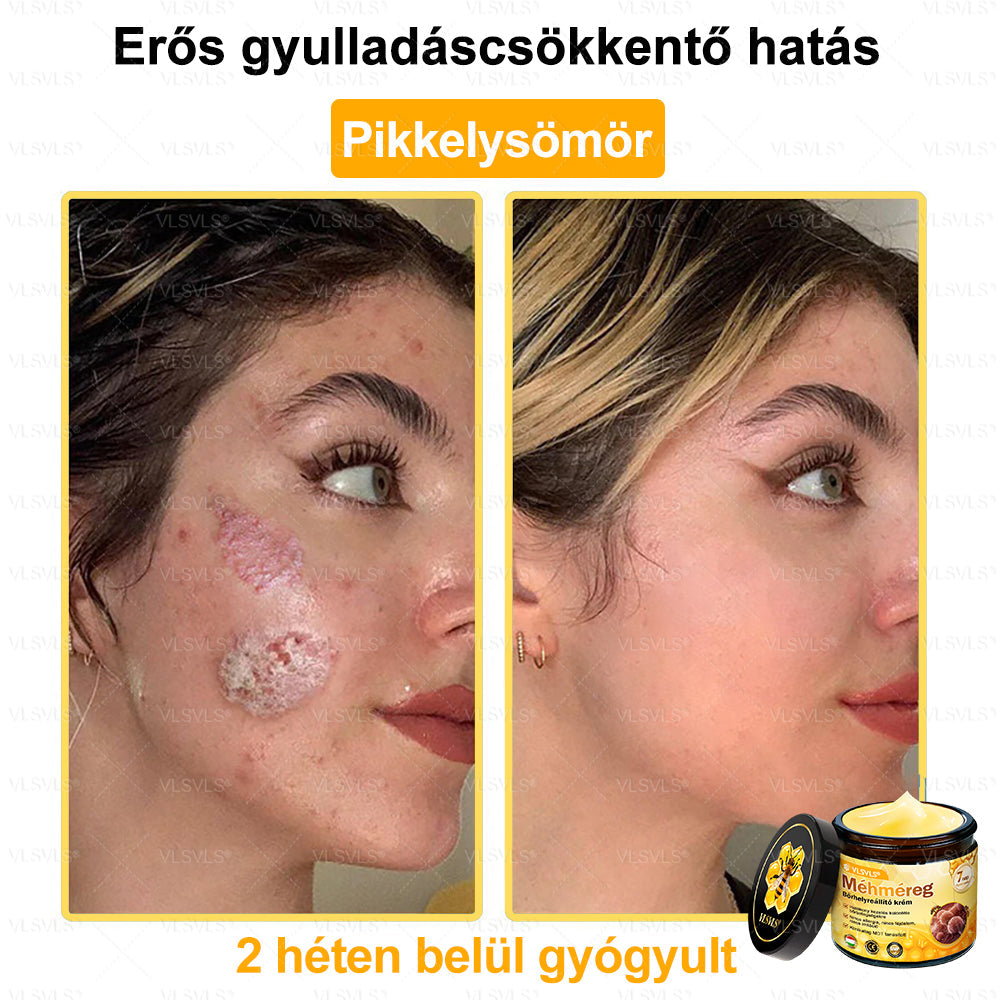 💪VLSVLS® Méhméreg Bőrhelyreállító Krém (👨‍⚕‍CE jóváhagyott)👍✅