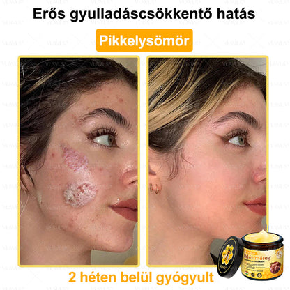 💪VLSVLS® Méhméreg Bőrhelyreállító Krém (👨‍⚕‍CE jóváhagyott)👍✅