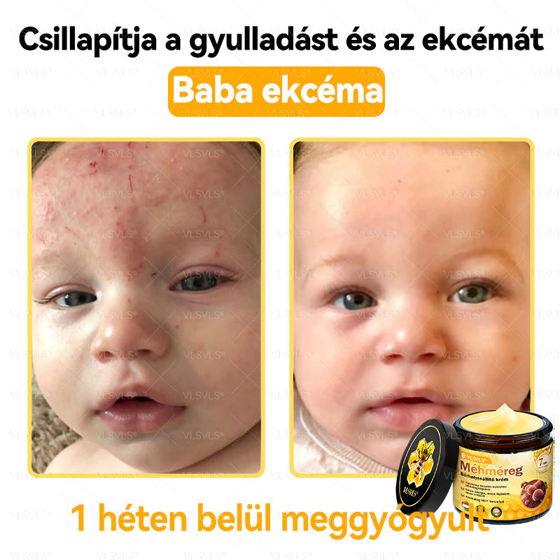 💪VLSVLS® Méhméreg Bőrhelyreállító Krém (👨‍⚕‍CE jóváhagyott)👍✅
